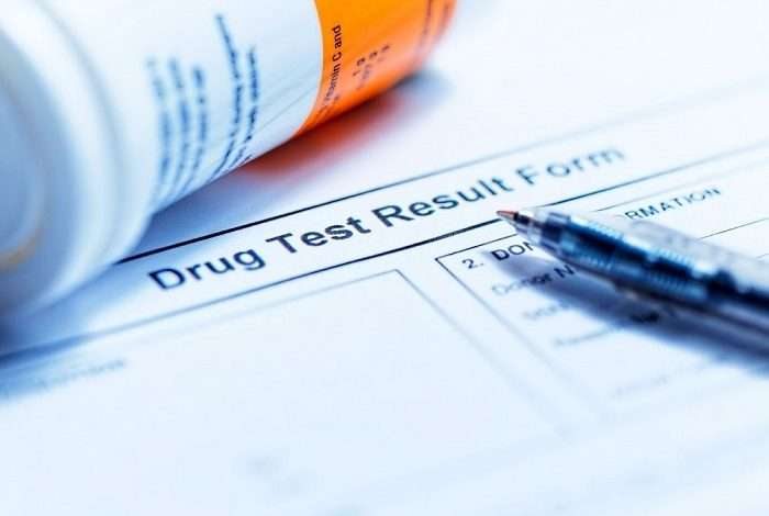 drug test result form with pen and container